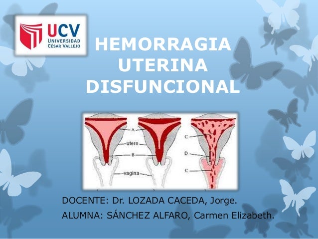 hemorragia disfuncional uterina